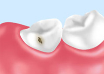 歯に痛みはありませんか？