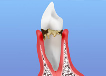 歯ぐきの違和感ありませんか？