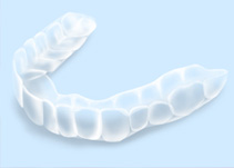 マウスピースで口腔内を守ろう