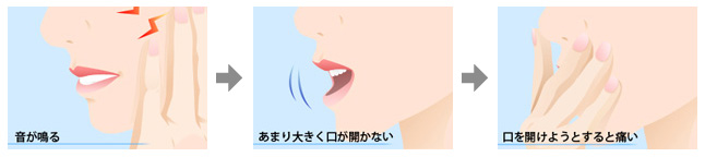 近年、特に女性に増えている病気「顎関節症」とは